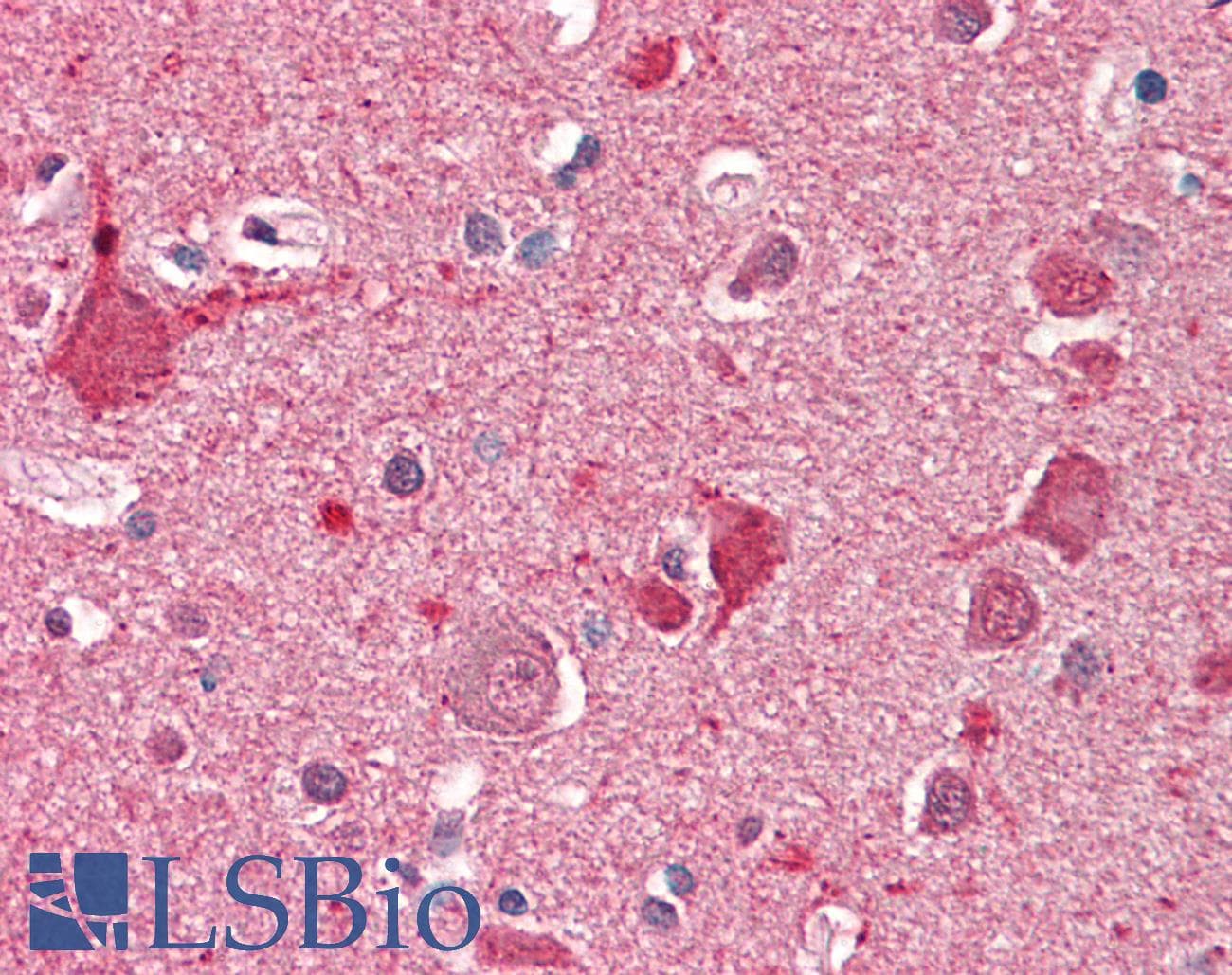 IHC-plus™ Polyclonal Goat anti-Human DOC2A Antibody (aa233-246, IHC)