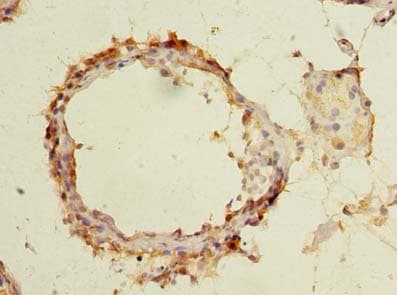 FAM126B Antibody