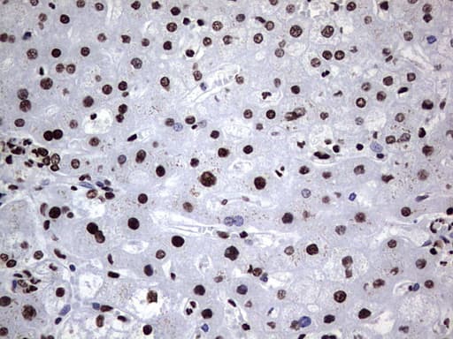 HNRNPL / hnRNP L Antibody (aa270-502, clone OTI9G7, Carrier-free)