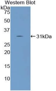 ANGPTL2 / ARP2 Antibody (aa267-493)