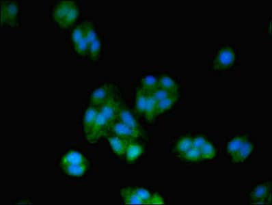 Polyclonal Rabbit anti-Human BTF3 Antibody (WB)