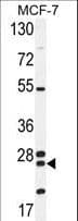 NUDT8 Antibody (aa42-70)