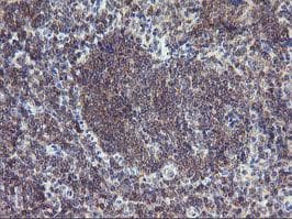 ERBB2 / HER2 Antibody (aa676-1255, clone OTI1A12, Carrier-free)