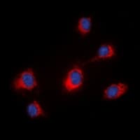 MID1 Antibody (N-Terminus)