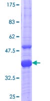 Human MR1 Protein (Recombinant GST, N-terminus)