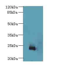 Polyclonal Rabbit anti-Human NICN1 Antibody (IHC, WB)