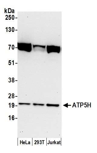 Polyclonal Rabbit anti-Human ATP5H Antibody (aa100-150, WB)