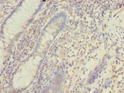 Polyclonal Rabbit anti-Human MFAP3L / NYD-Sp9 Antibody (IHC)