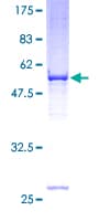 Human VDAC2 Protein (Recombinant GST)