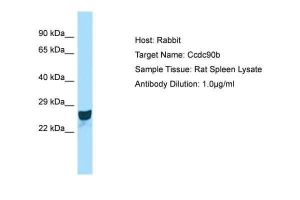 CCDC90B Antibody (aa151-200)