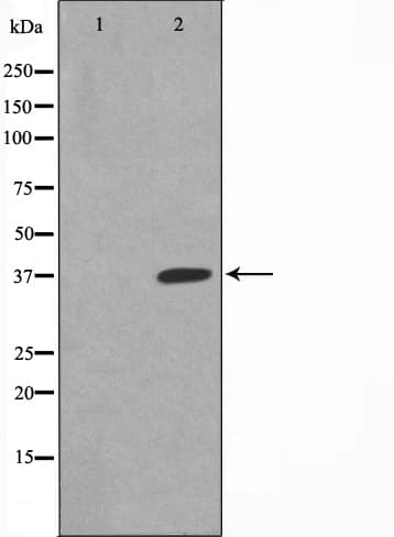 Polyclonal Rabbit anti-Human NFKBIA / IKB Alpha / IKBA Antibody (phospho-Ser32,phospho-Ser36, IHC, IF, WB)