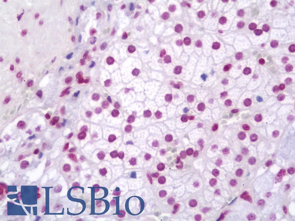 IHC-plus™ Polyclonal Rabbit anti-Human ZC3H12A / MCPIP1 Antibody (aa331-358, IHC, WB)