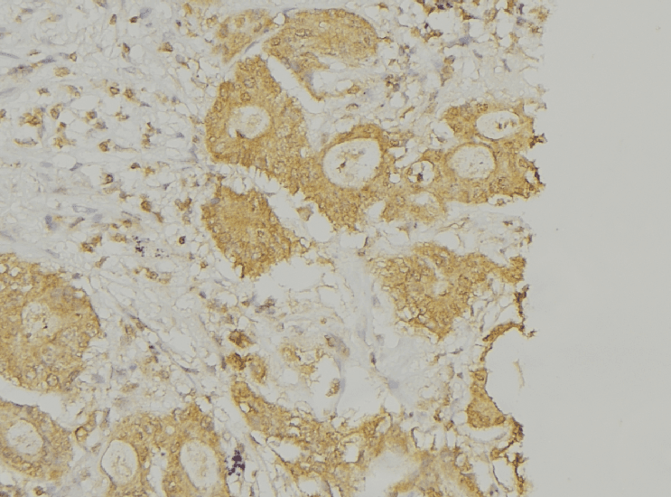 Polyclonal Rabbit anti-Human PLA2G4A Antibody (IHC, IF, WB)