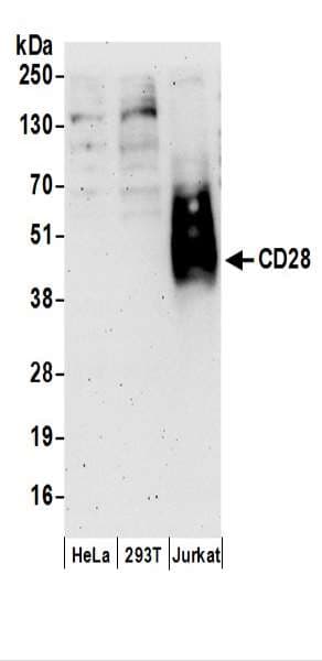 IHC-plus™ CD28 Antibody (aa1-50)