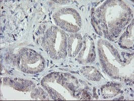 RIPK1 / RIP Antibody (aa133-422, clone OTI2D6, Carrier-free)