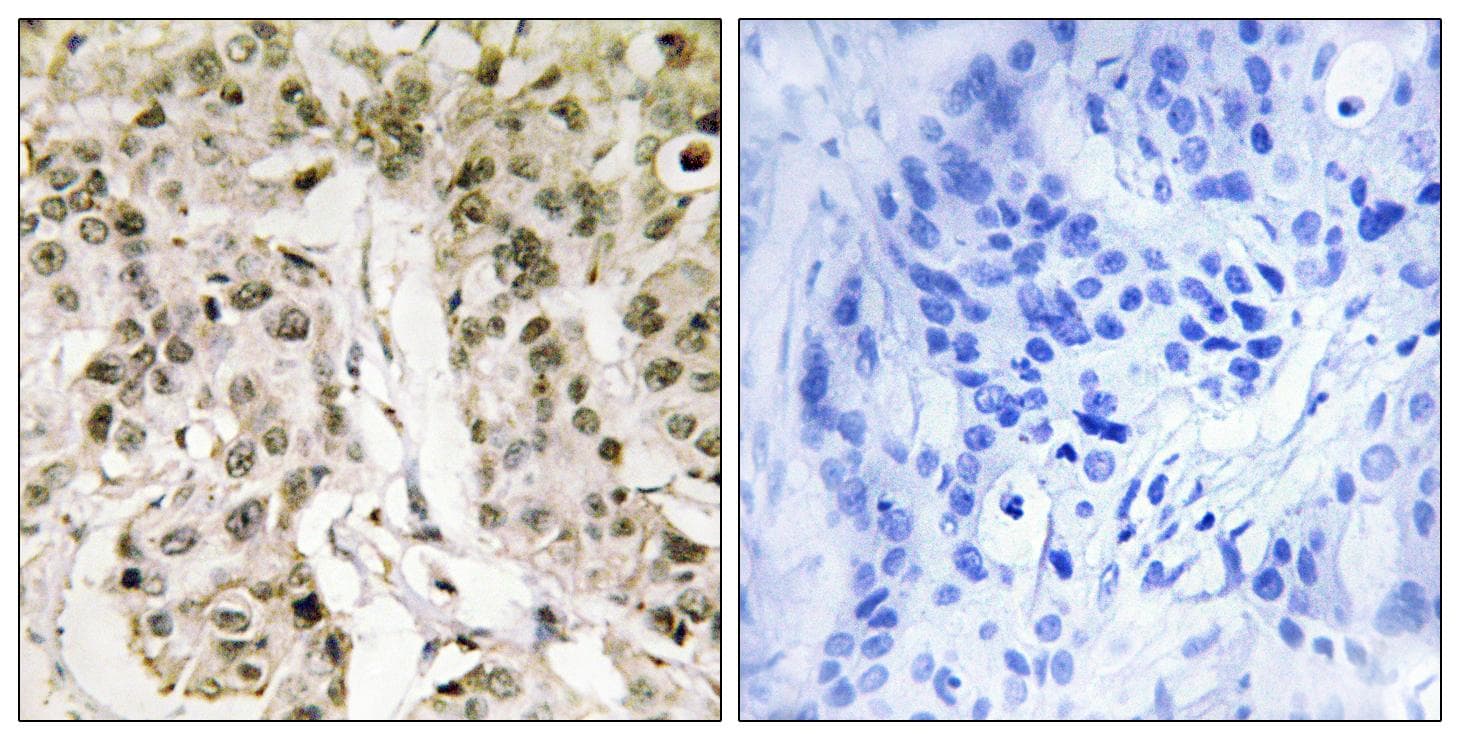 HCF1 / HCFC1 Antibody