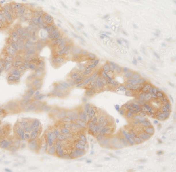 BRUCE / BIRC6 Antibody (aa4775-C-term)