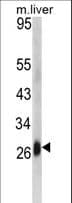 Polyclonal Rabbit anti-Human CD302 Antibody (aa143-170, IHC, WB)