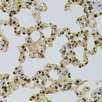 CREBBP / CREB Binding Protein Antibody