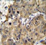 TMEM100 Antibody (aa93-122)