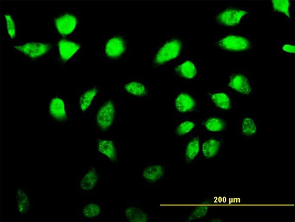 Monoclonal Mouse anti-Human AKAP17A / 721P Antibody (clone 2G8, IF, WB)