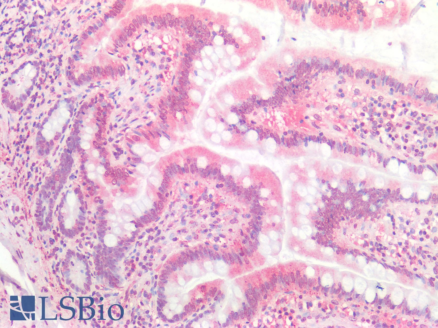 PathPlus™ Monoclonal Mouse anti-Human TMIGD2 Antibody (clone 7A10, IHC, IF)