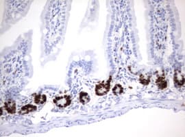 MKI67 / Ki67 Antibody (aa1160-1493, clone OTI13B11)
