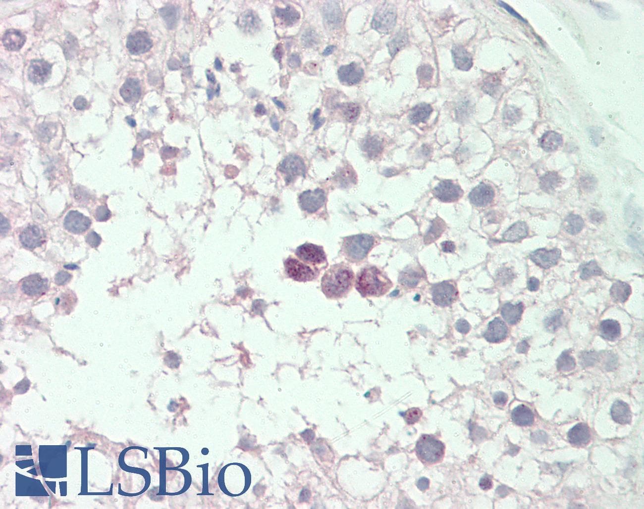 IHC-plus™ SLCO6A1 / OATP-I Antibody (aa678-707)