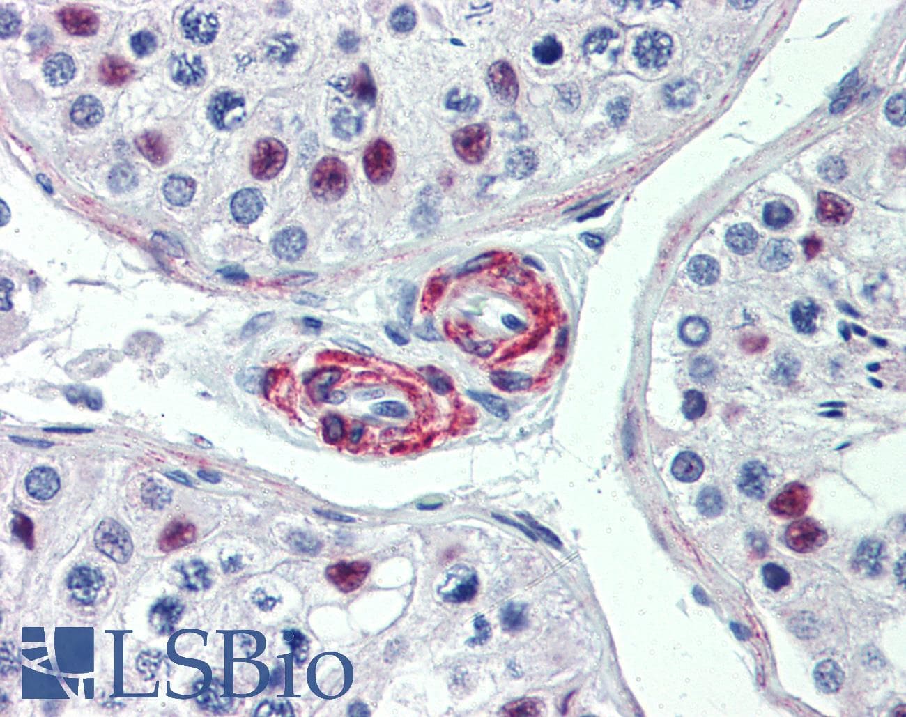 Polyclonal Rabbit anti-Human KIF13B / GAKIN Antibody (aa107-156, IHC, WB)