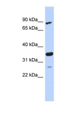 Polyclonal Rabbit anti-Human PDIK1L Antibody (aa179-228, WB)