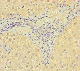 SRPK3 / MSSK1 Antibody
