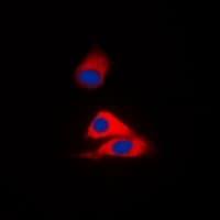 Polyclonal Rabbit anti-Human MVK Antibody (Internal, IHC, IF, WB)