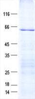 Human CDC7 Protein (Recombinant His, N-Terminal)