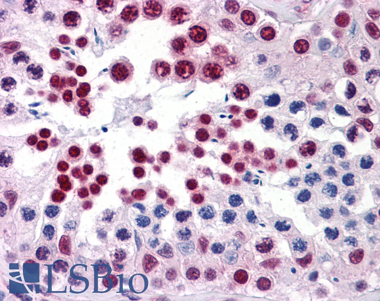 IHC-plus™ Monoclonal Mouse anti-Human ELAVL1 / HUR Antibody (clone 4G8, IHC, IF, WB)