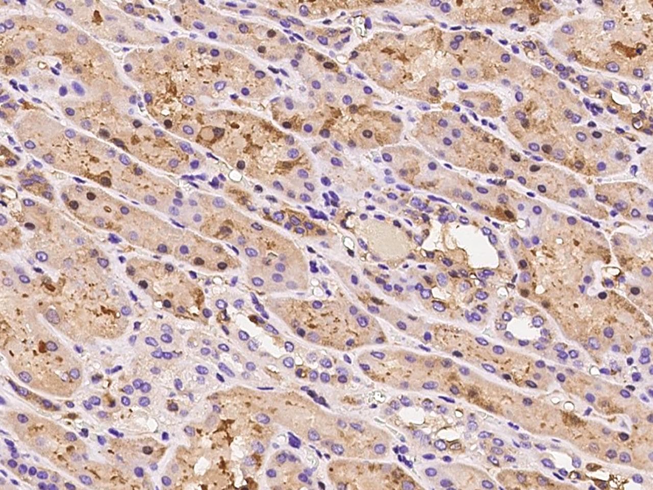 Polyclonal Rabbit anti-Human HEMK1 Antibody (IHC)