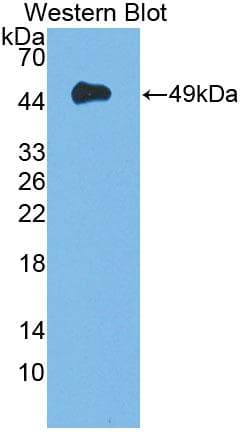 DAG1 / Dystroglycan Antibody (aa28-406)