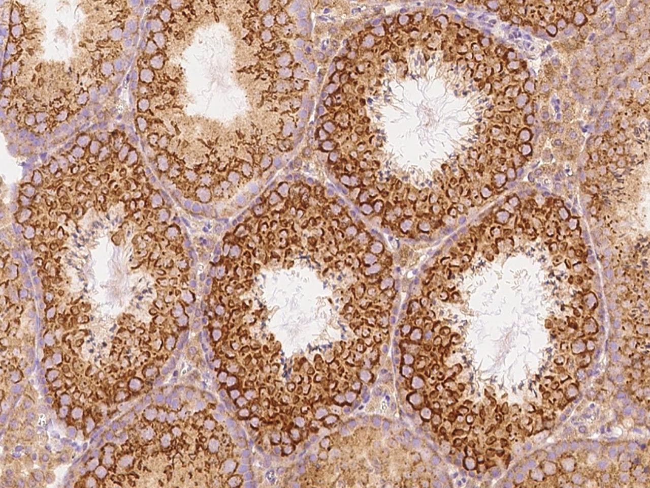 GFRA3 Antibody (Preservative Free)