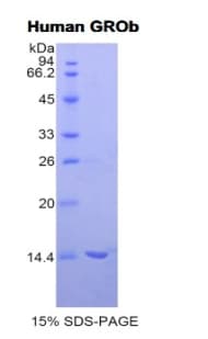 Human MIP2 / GRO2 / CXCL2 Protein (Recombinant His-T7)