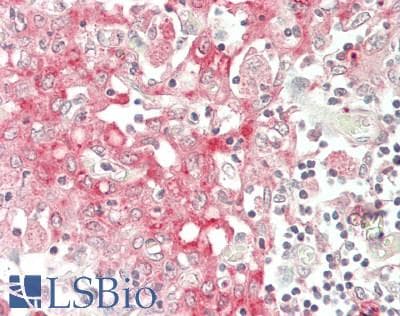 IHC-plus™ CD144 / CDH5 / VE Cadherin Antibody (aa697-746)