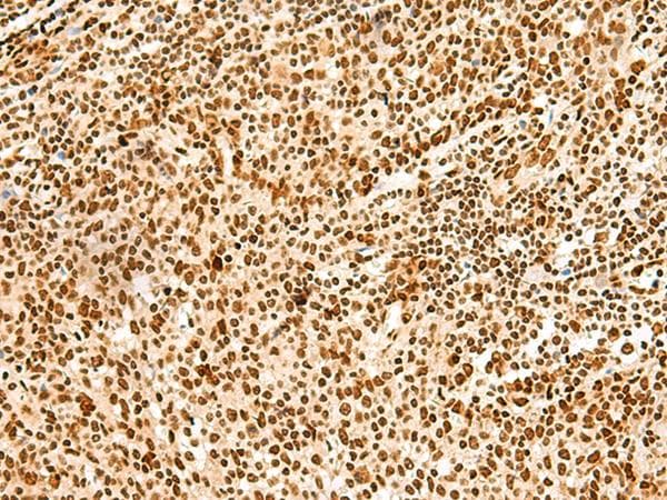 Polyclonal Rabbit anti-Human HNRNPA3 / HnRNP A3 Antibody (IHC, WB)