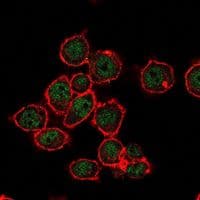 SUZ12 Antibody (clone 2C11)