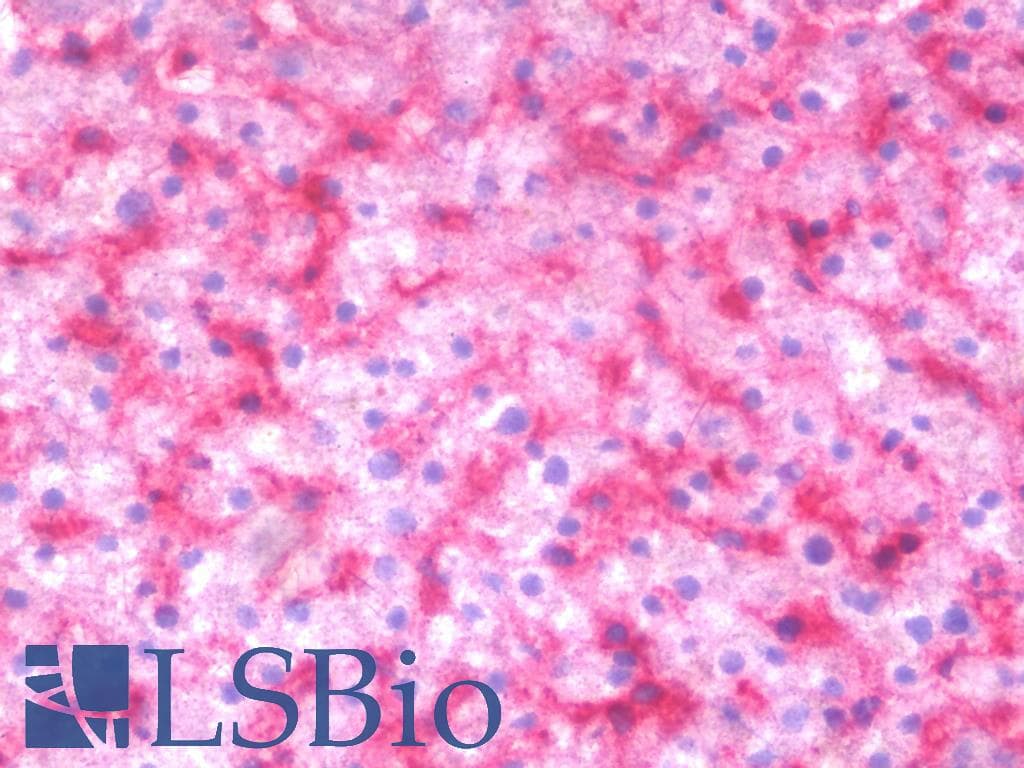 IHC-plus™ Monoclonal Mouse anti-Human MAP3K11 / MLK3 Antibody (clone 3D11, IHC, WB)