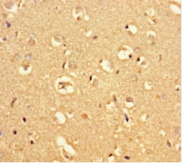 Polyclonal Rabbit anti-Human MRAP2 Antibody (WB)