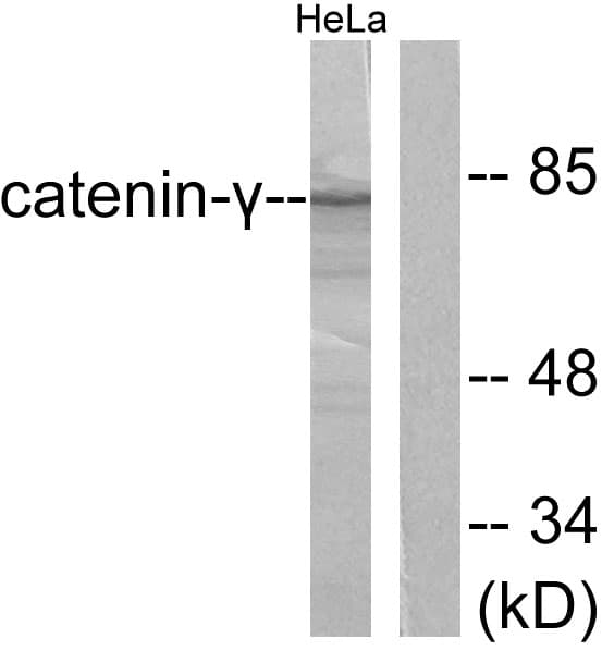 IHC-plus™ JUP/CTNNG/Junction Plakoglobin Antibody (aa696-745)