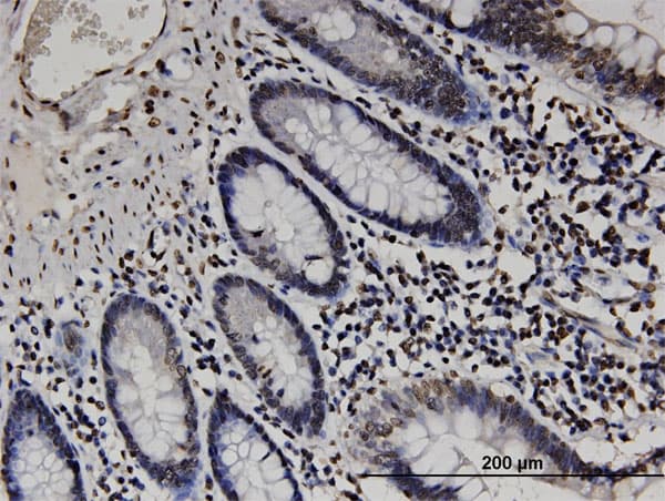 RABGAP1L Antibody (clone 2D3)