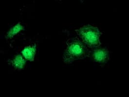 SNTA1 / Syntrophin Alpha 1 Antibody (clone OTI2D5)