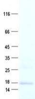 Human MMGT1 Protein (Recombinant His, N-Terminal)