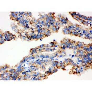 ALDH2 Antibody (aa18-48)