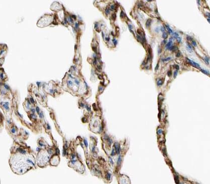 TNFAIP8 / SCC-S2 Antibody