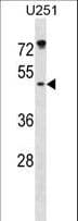Polyclonal Rabbit anti-Human ILKAP Antibody (aa93-122, WB)